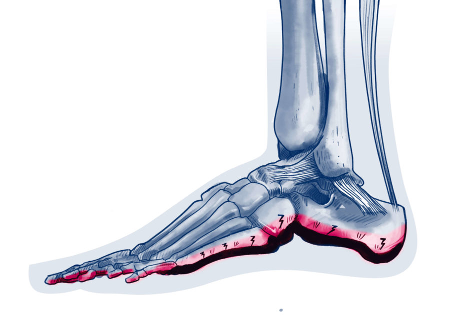 Pathologies Cheville ISCO Institut Spécialisé de Chirurgie Orthopédique à StrasbourgISCO
